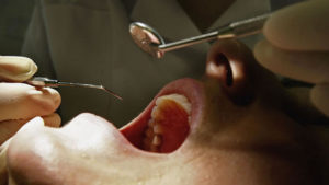 Dental Exclusion